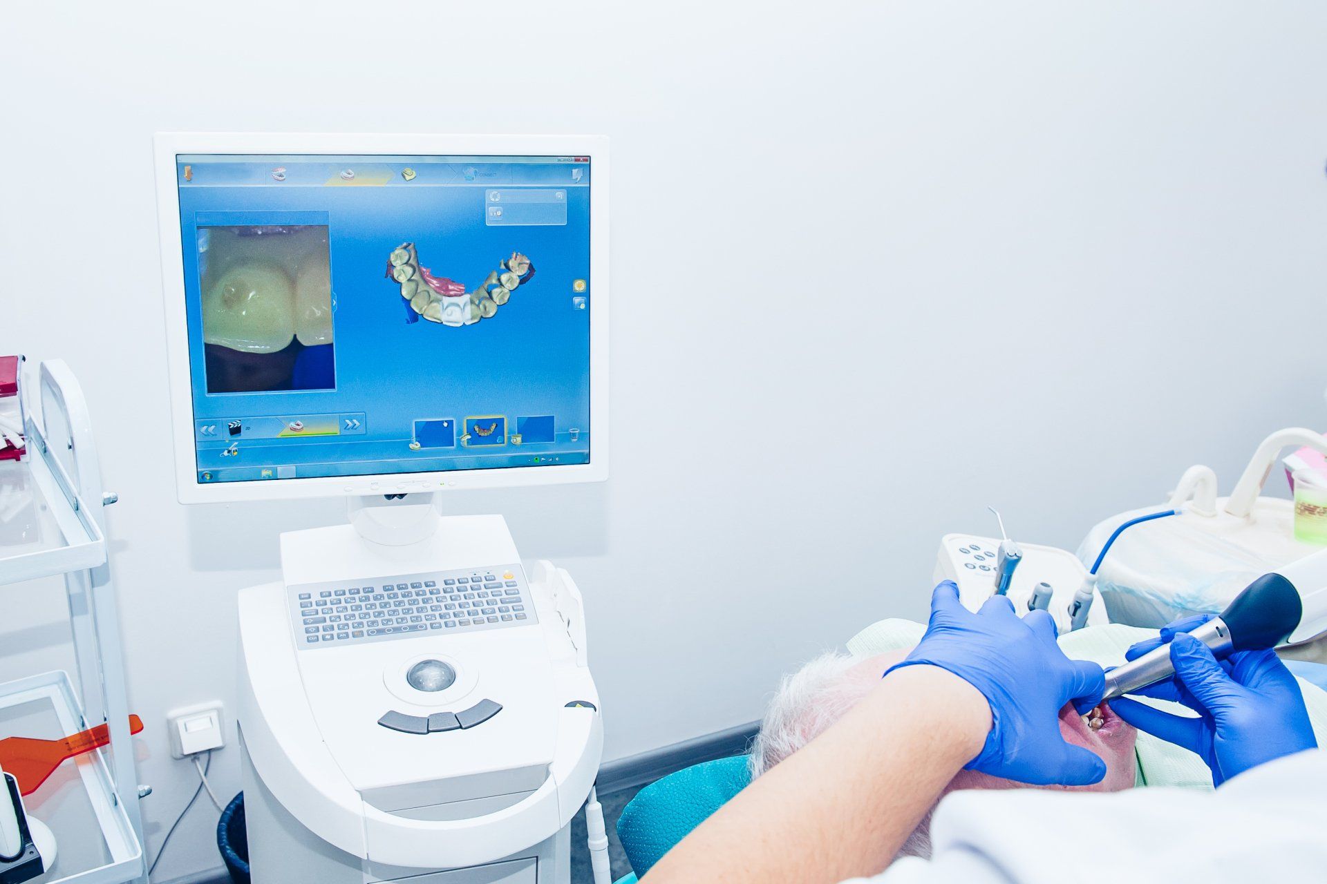 Dental technology | Dental 3D scanner | dentist near you | using a 3d scanner on a patient with a computer | Dr. Ray T Chow Dentistry | Victoria Dentist