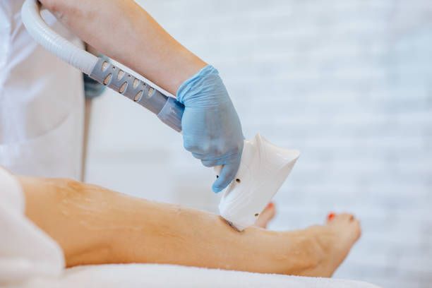 A Woman Is Getting A Laser Hair Removal Treatment On Her Leg - Latrobe, PA - Laser180