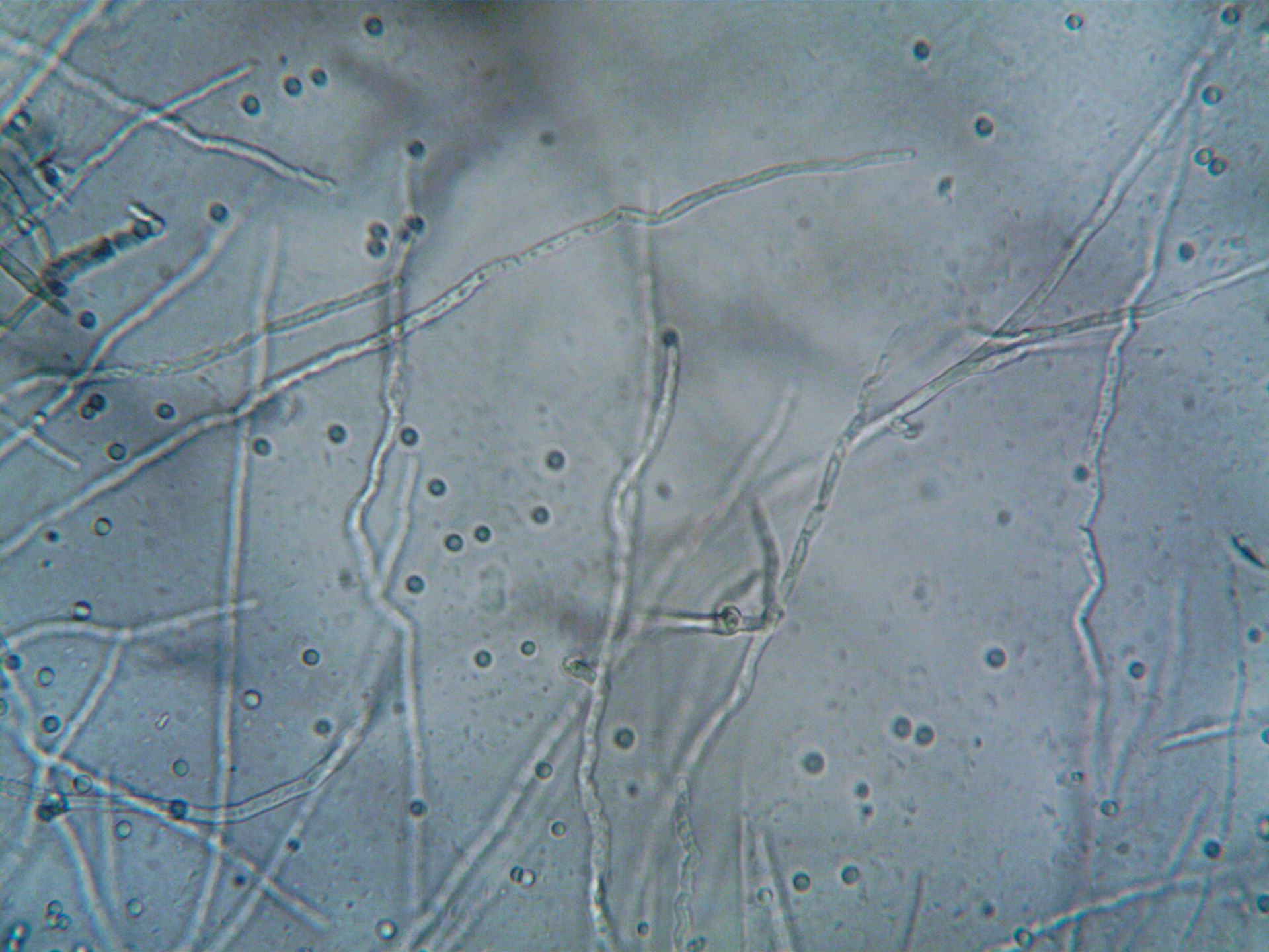 Microscopic view of translucent filaments and scattered round cells on a gray-blue background