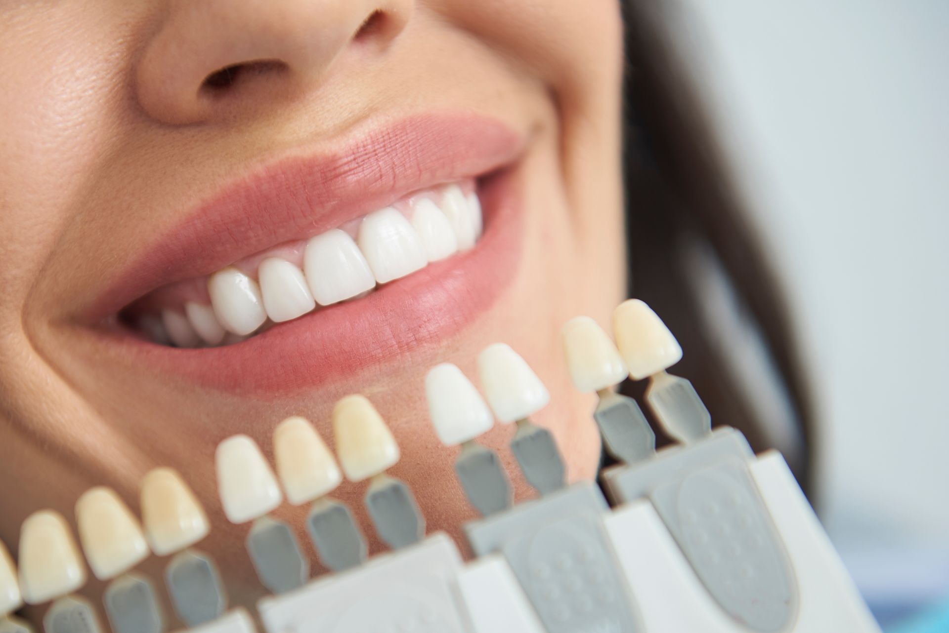 Dental shade guide held beside a patient's smile during a cosmetic dentistry consultation