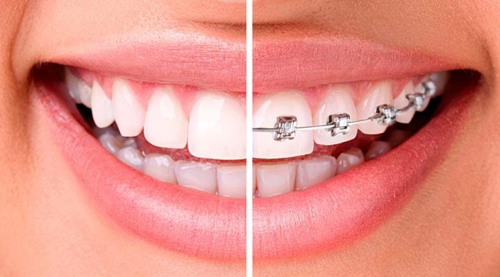 DENTAL ADVANCE