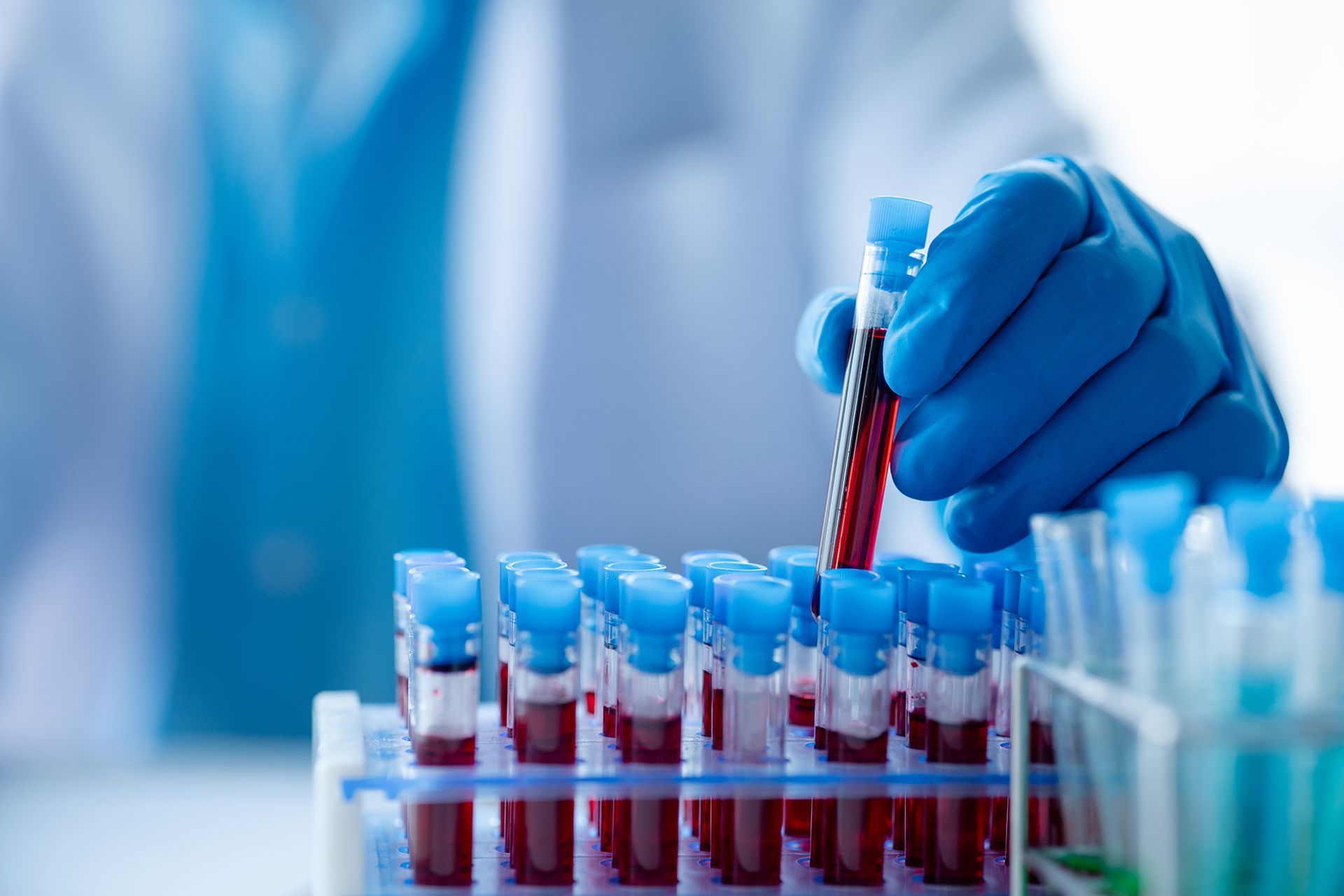 From the manufacturing facility to the vaccination site requires precise temperature control to maintain its efficacy. From the manufacturing facility to the vaccination site requires precise temperature control to maintain its efficacy.
