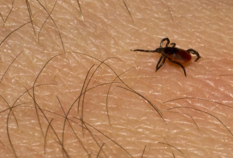 Tick on human skin with visible hairs.