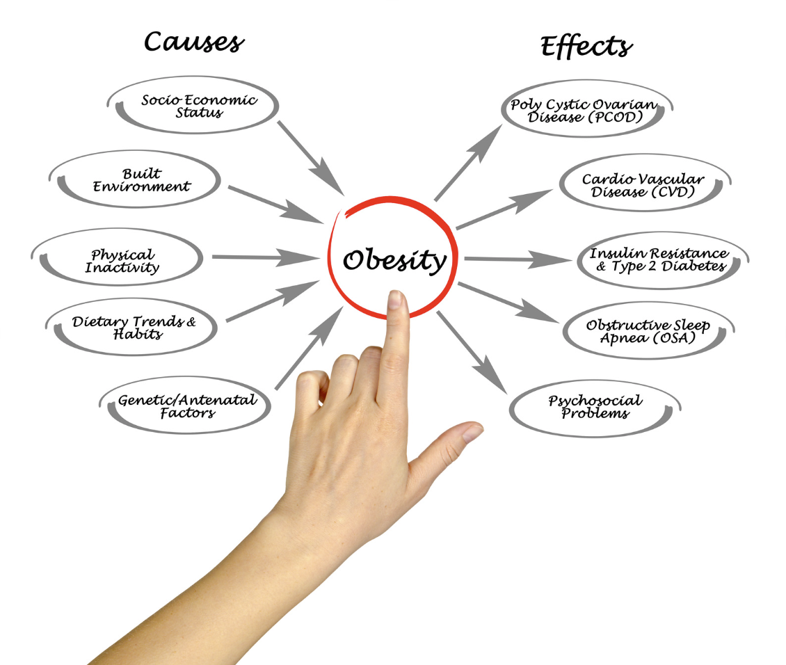 Obesity causes and effects diagram with lifestyle and health factors