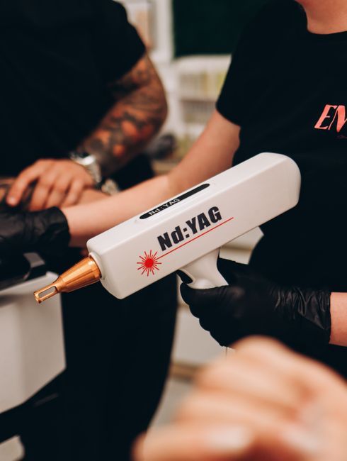 Close-up of laser tattoo removal treatment being applied to skin