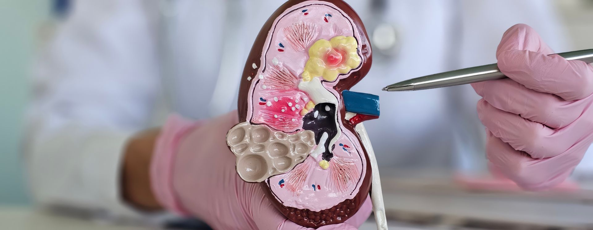 Close-up of an anatomical kidney model with a pointer highlighting internal structures.