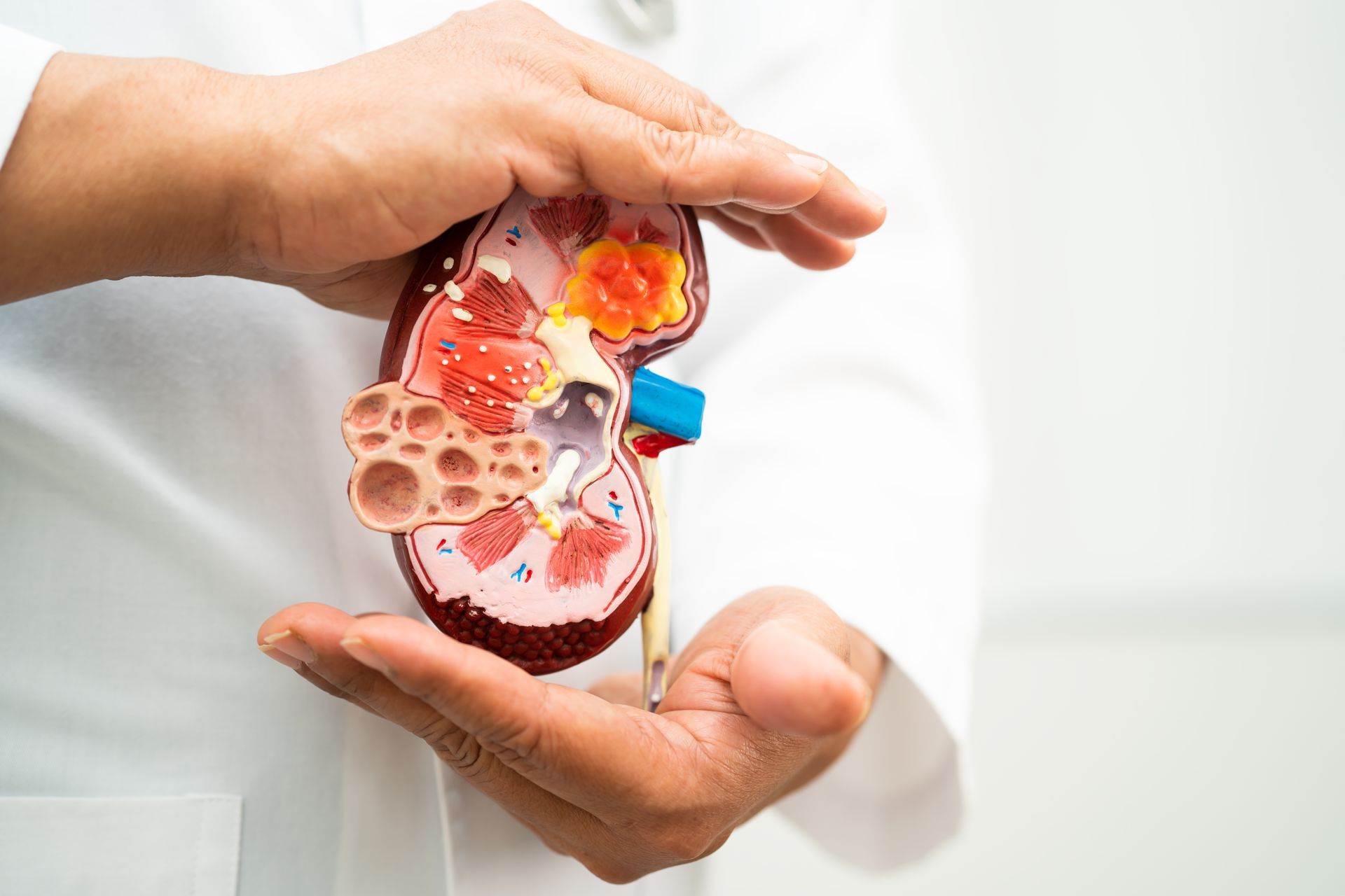 Medical professional holding an anatomical kidney model, illustrating kidney structure.