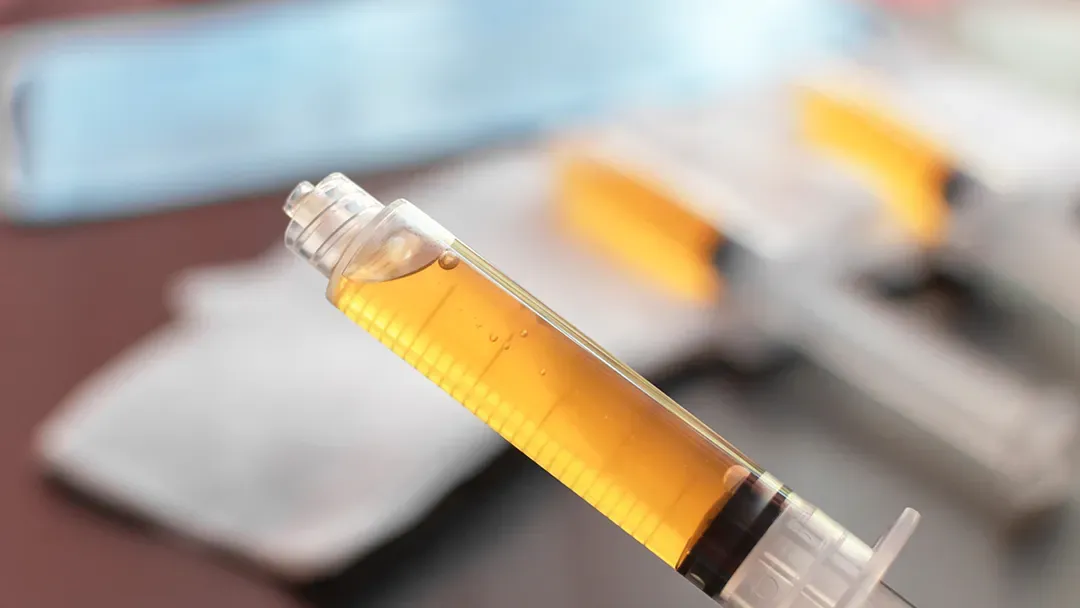 Syringe filled with yellowish liquid, likely for medical treatment, in a clinical setting.