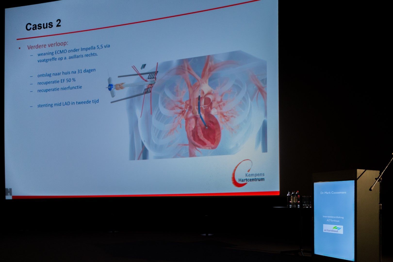 Presentatieslide met het label