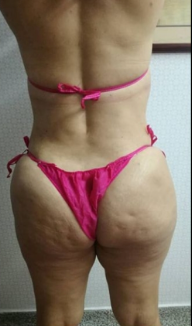 Vista trasera de una persona que lleva un bikini rosa brillante, mostrando la textura de la piel en la parte inferior