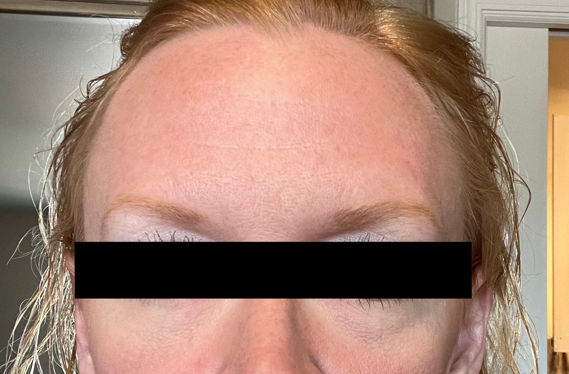 Person's forehead and eyes, blurred out eyes, light skin, light reddish-blonde hair.