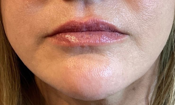 Close-up of a person's lower face, focusing on full, glossy lips with subtle shading, and skin with a slight sheen.