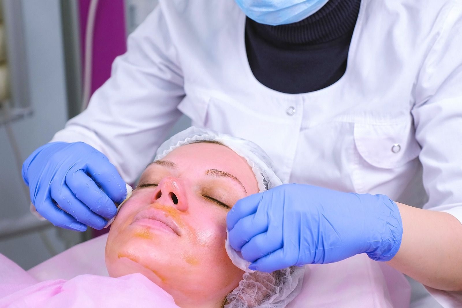 Person receiving facial treatment, gloved hands cleaning face with cotton pads.