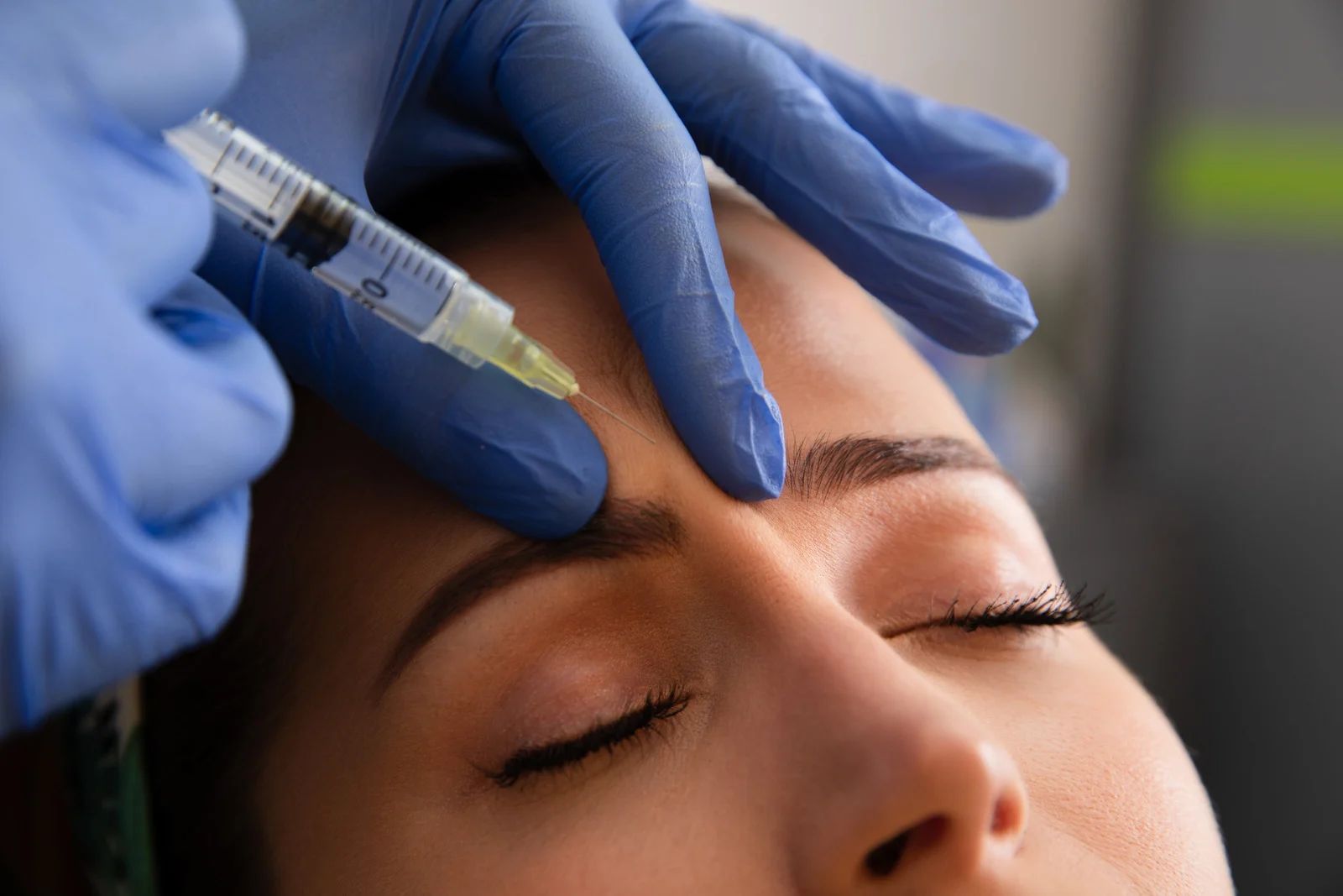 Person receiving cosmetic injection in the forehead. Blue gloved hand holds syringe near closed eyes.
