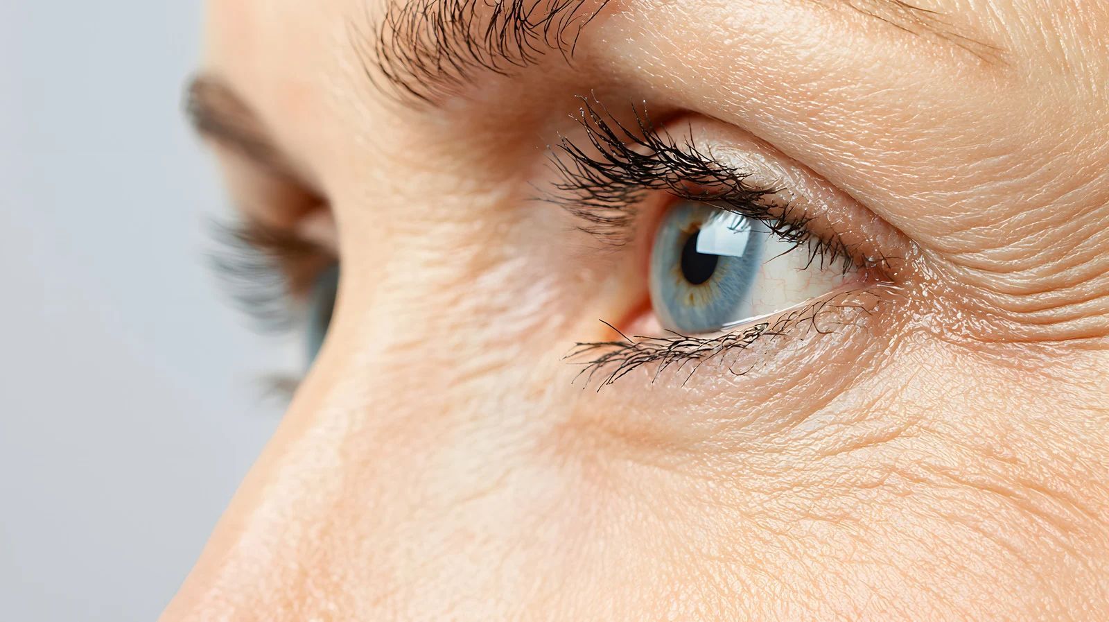 Close-up of a blue eye with visible wrinkles around it.