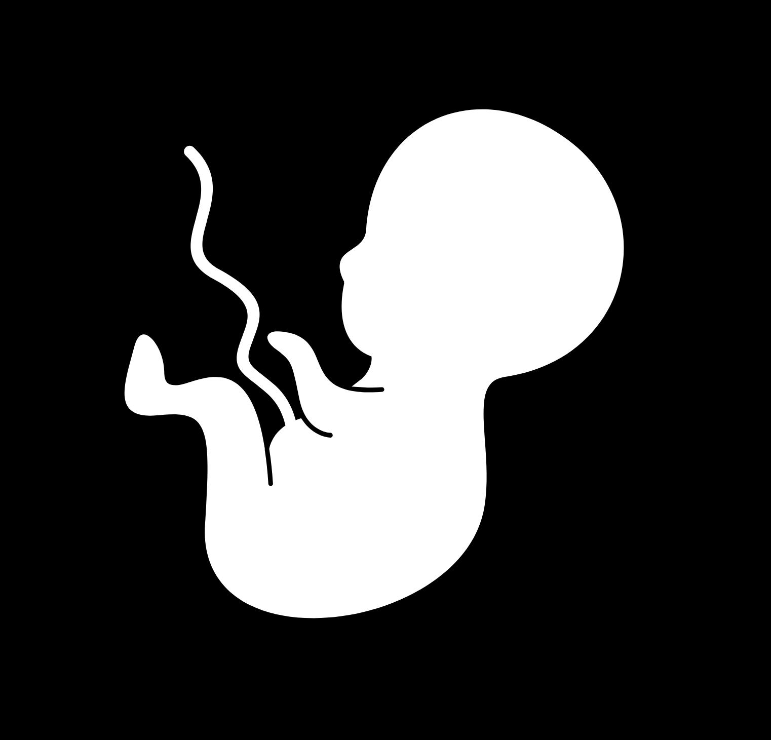 FETUS