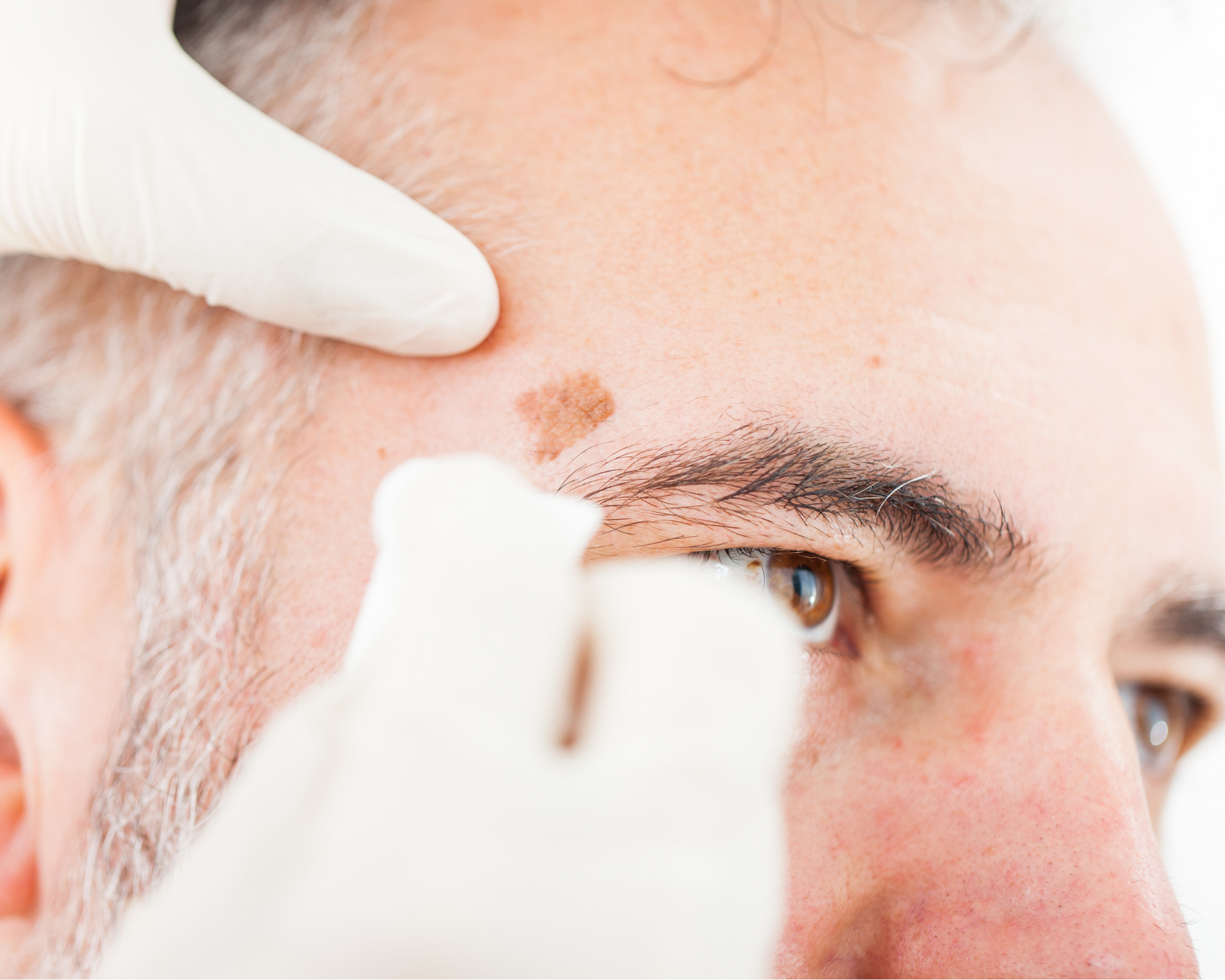 A man is getting his skin examined by an esthetician.