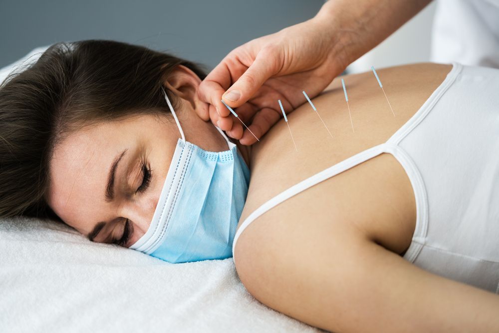 Woman Wearing a Mask Receiving Acupuncture — PhysioCare Townsville in Hyde Park, QLD