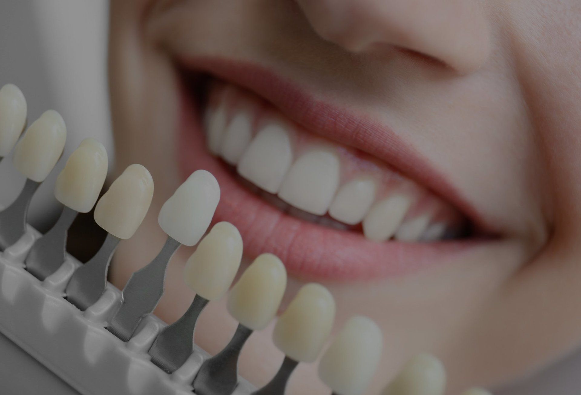 Dental Crowns