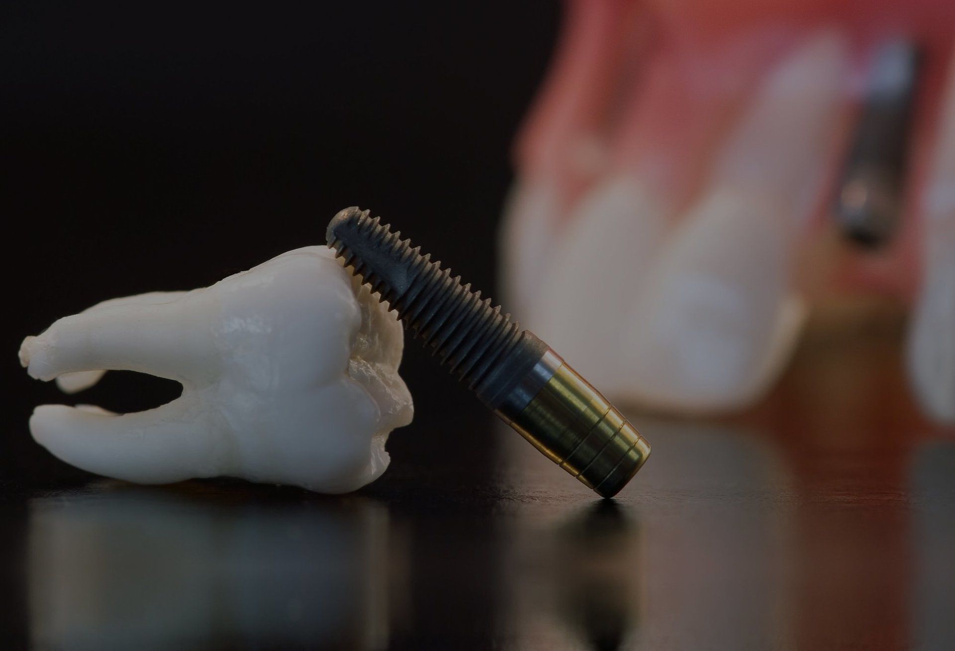 white dental implant with a metal screw