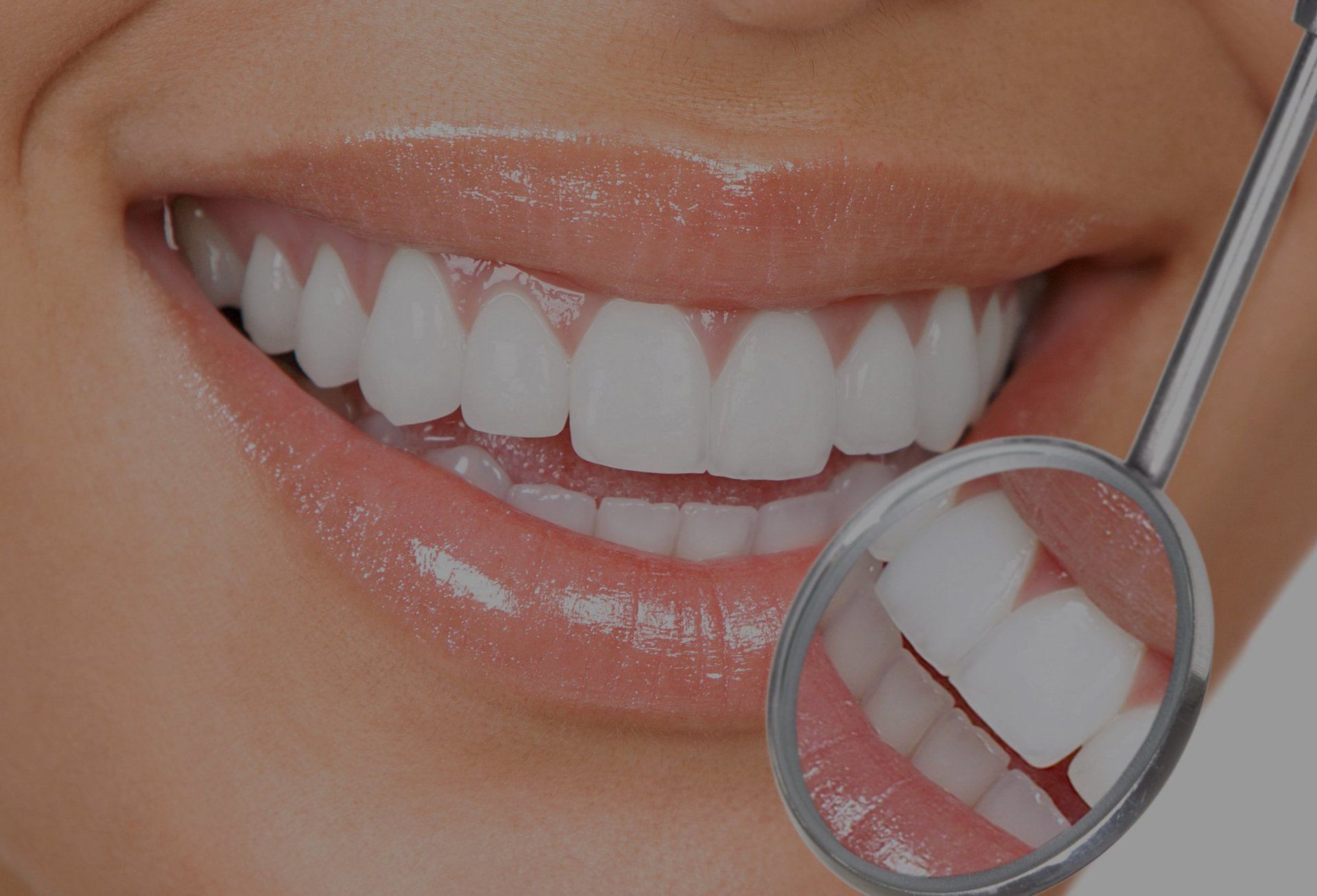 smiling mouth showing white teeth