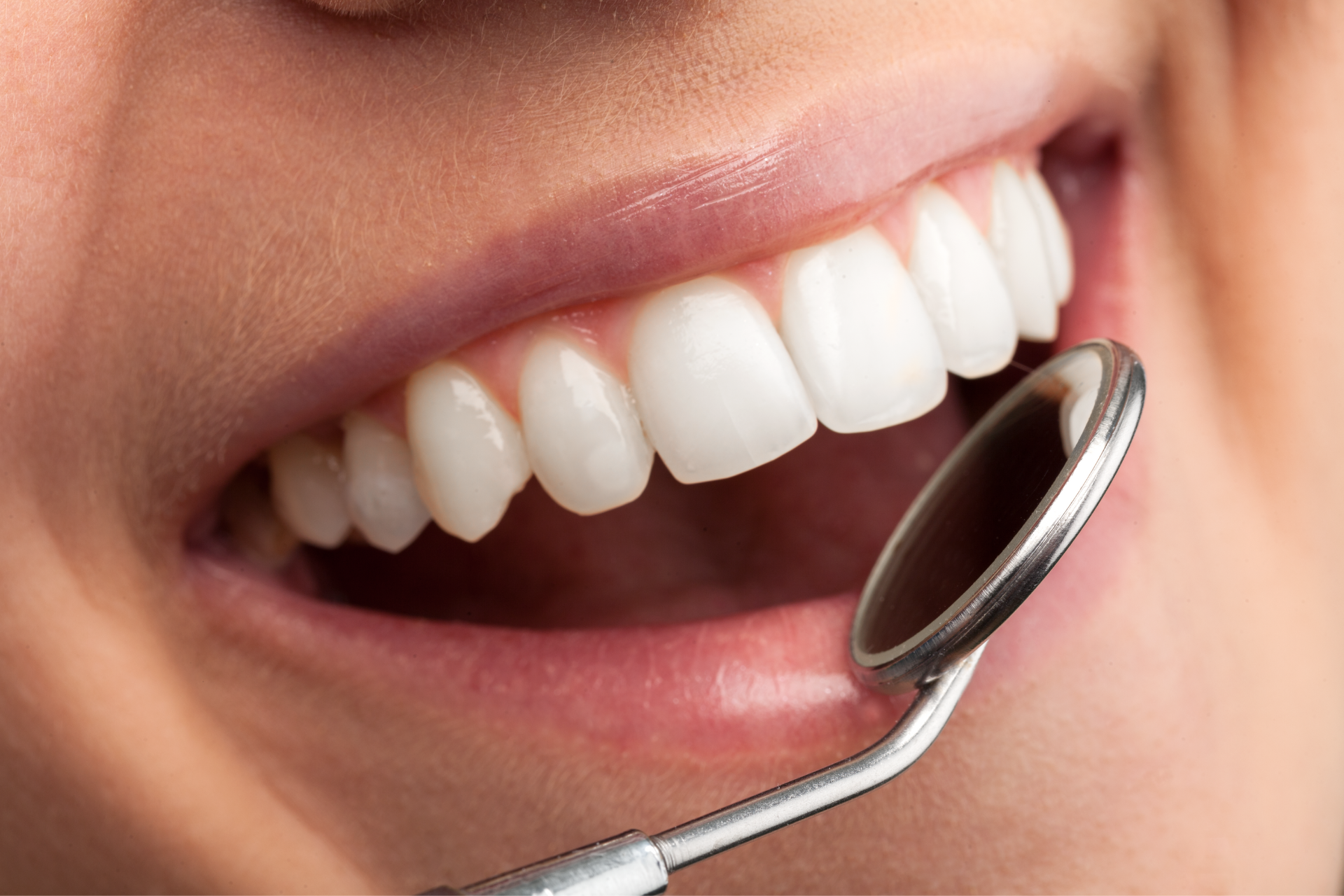 Gros plan sur des dents saines examinées à l'aide d'un miroir dentaire.