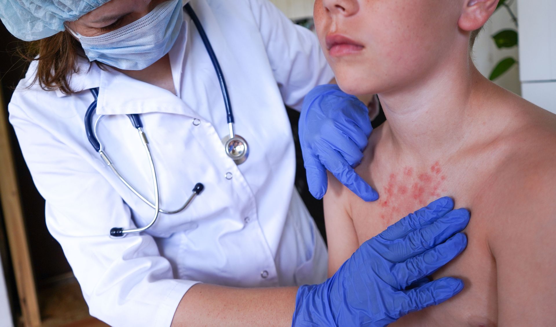 Common Skin Conditions Treated by a Pediatric Dermatologist