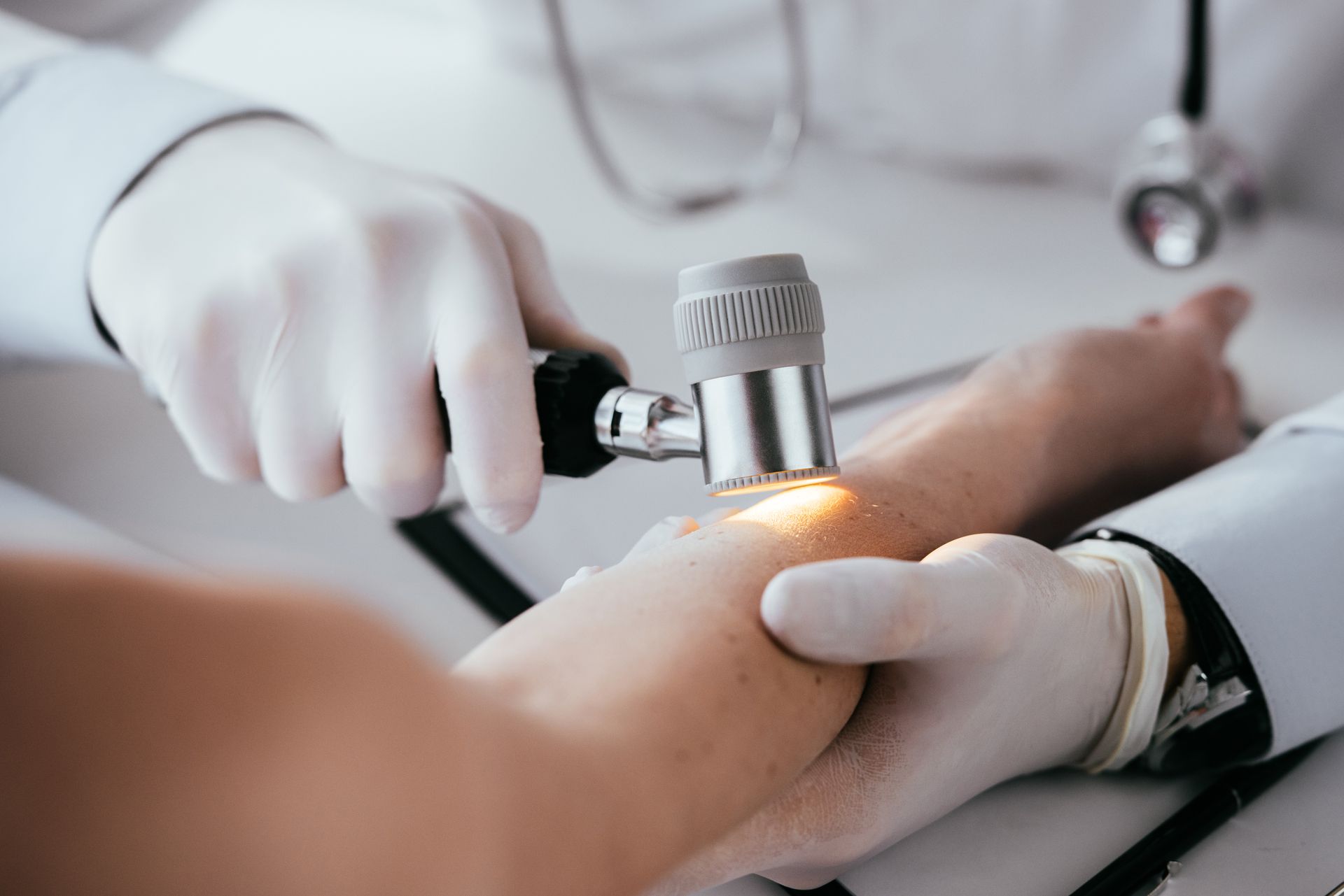 A cosmetic dermatologist examines a mole on a patient's forearm using a handheld dermatoscope tool.