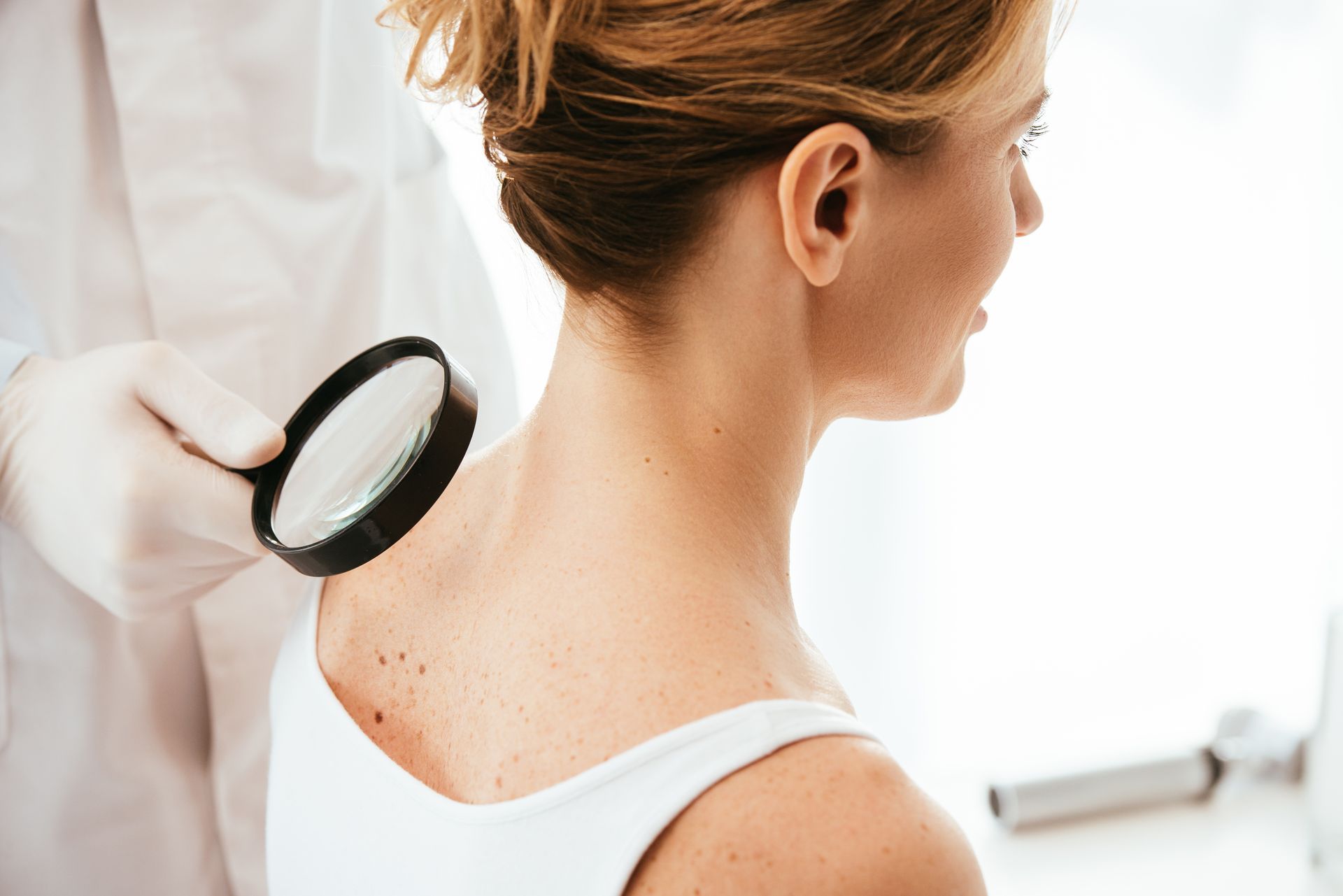 Dermatologist checking freckles and moles on a patient's back and shoulder with a magnifying glass.