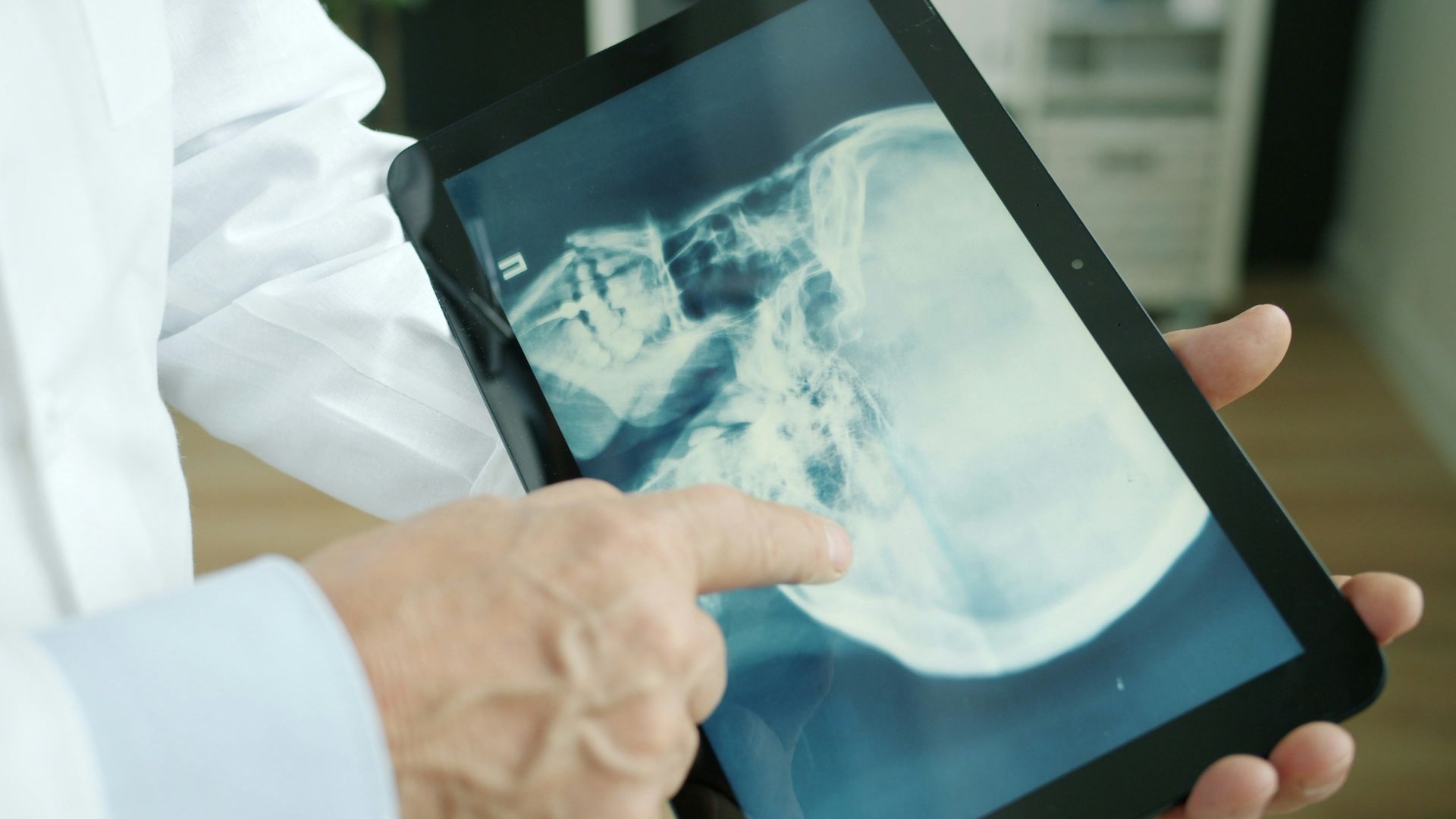 El médico señala una radiografía en la pantalla de una tableta.