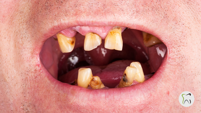 what happens if you hold vape smoke in your mouth How Smoking and Vaping Affect Oral Health FLAVORS:CALIFORNIA CHERRY Vape Kit Type_Starter Kit Walgreens Usb C Charger