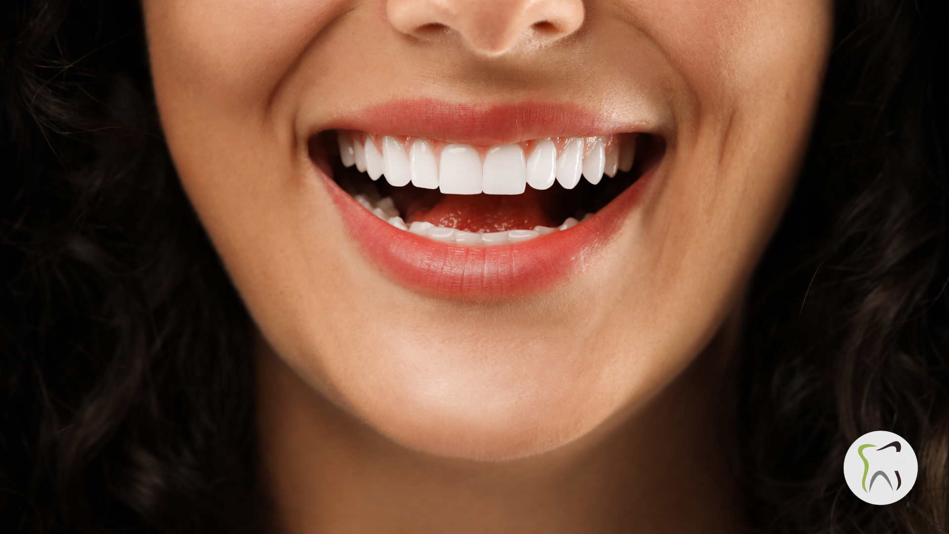 Woman smiling, showing perfect white teeth.