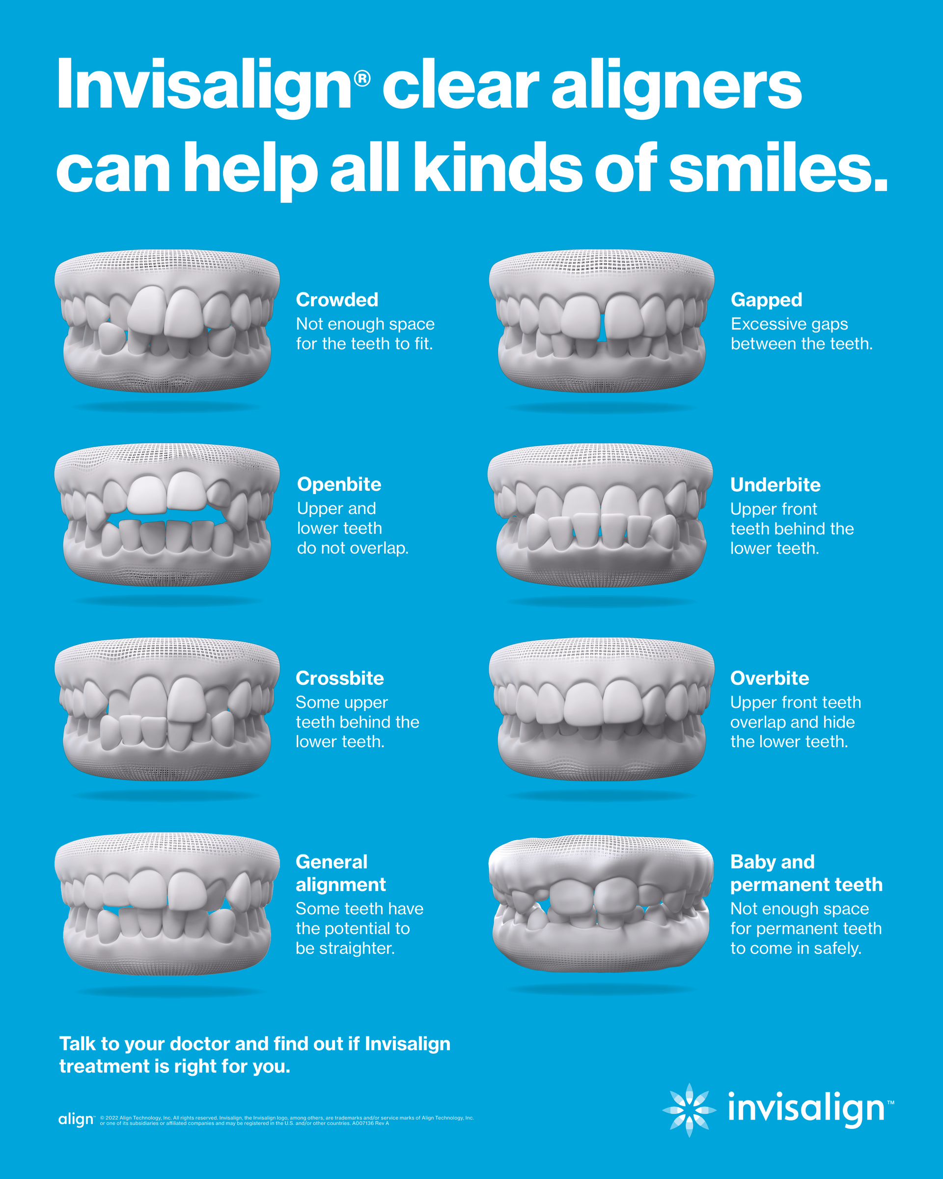Invisalign ad showing clear aligners correcting teeth for several bite and crowding issues