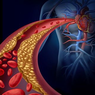 VALORACION PREOPERATORIA
