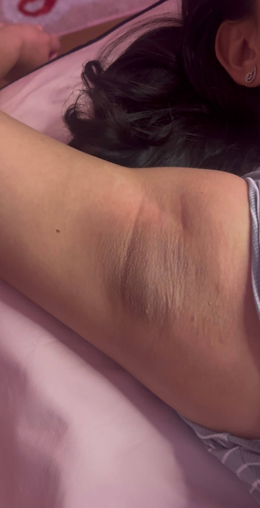 Close-up view of an underarm area showing skin texture and slight hyperpigmentation against a pink background.
