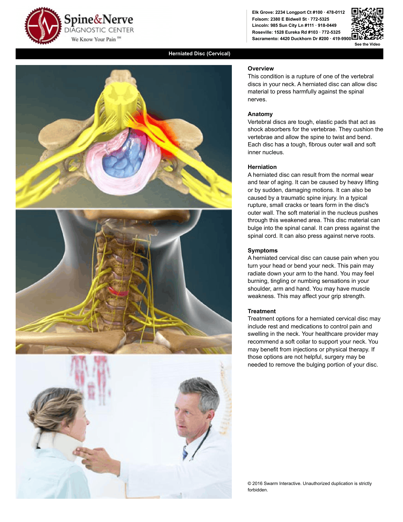 Herniated Discs (cervical)