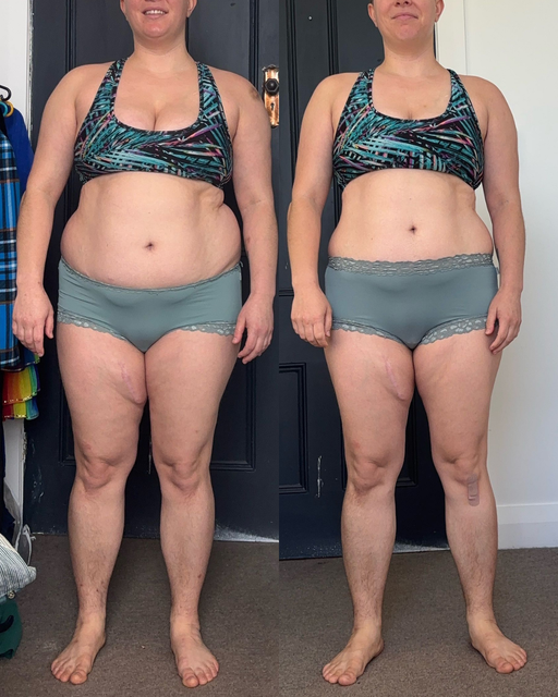 Side-by-side front-view body comparison: person in sports bra and shorts, before and after progress photos.