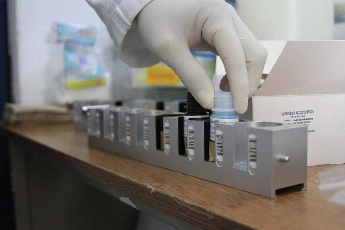 DR. JOSÉ CARLOS GONZÁLEZ ACOSTA - TRATAMIENTO DE ANEMIA
