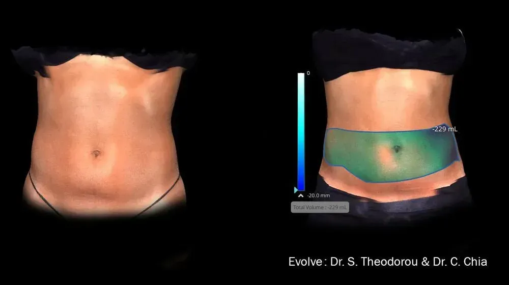 muscle toning