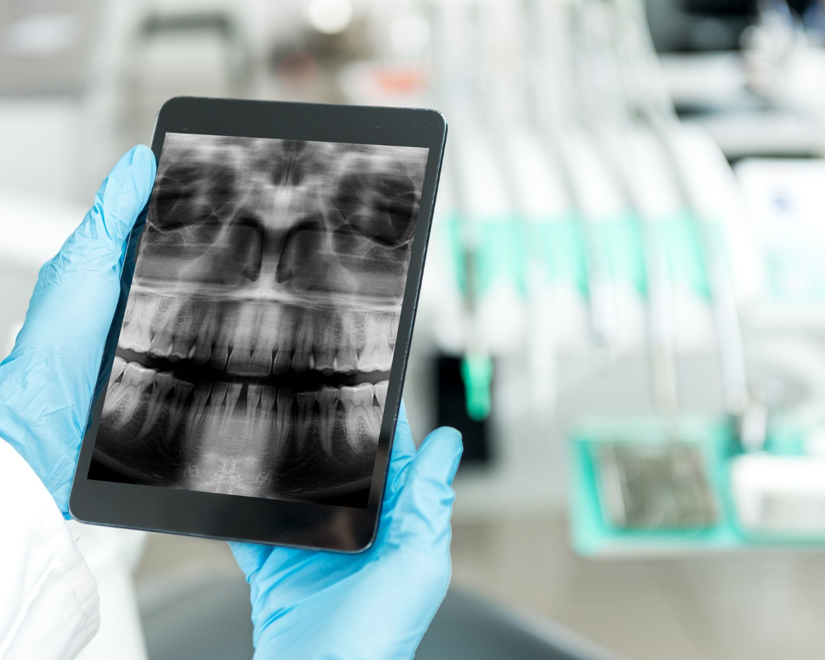 Dentist's gloved hands holding a tablet displaying a panoramic dental X-ray, with dental equipment blurred in the background.