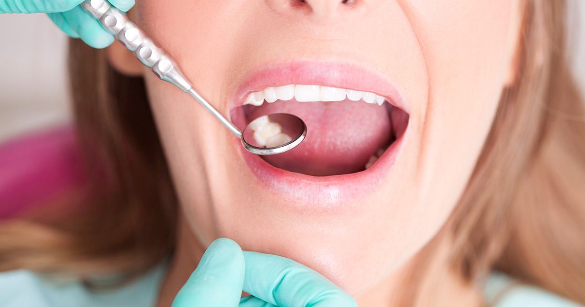Dental Fillings, Dentist in Owings Mills, MD