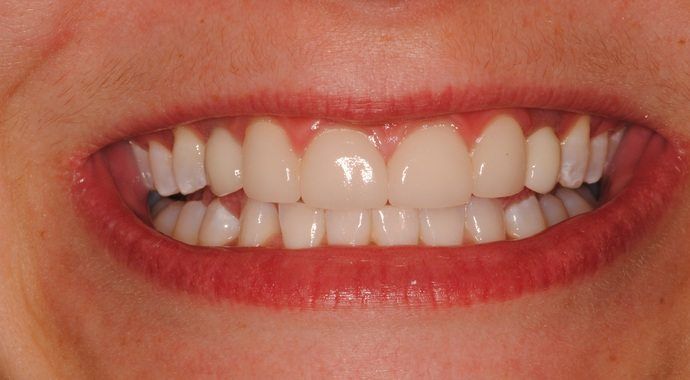 smile makeover, cosmetic dentistry