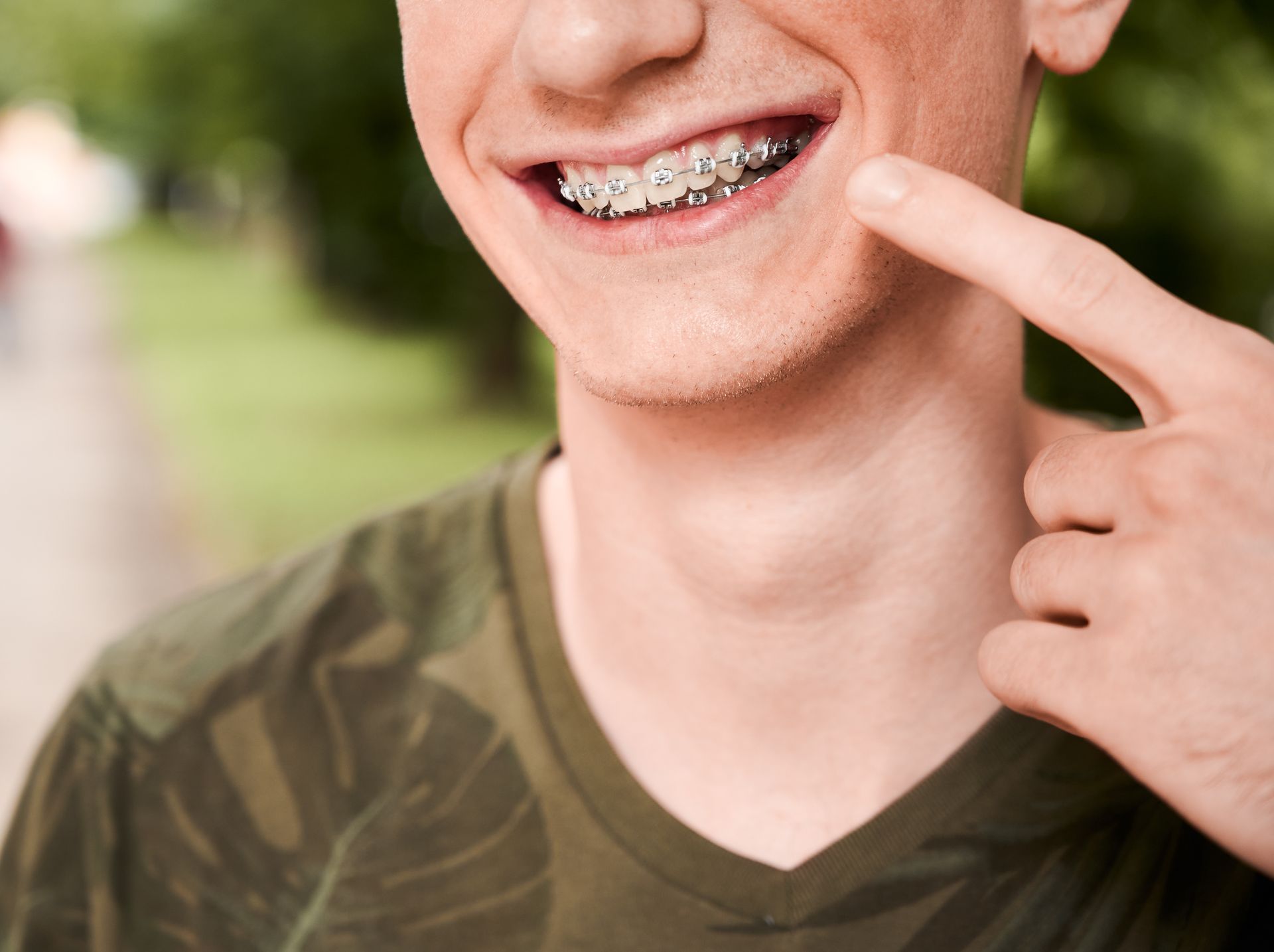A young man with braces is smiling and pointing at his teeth.