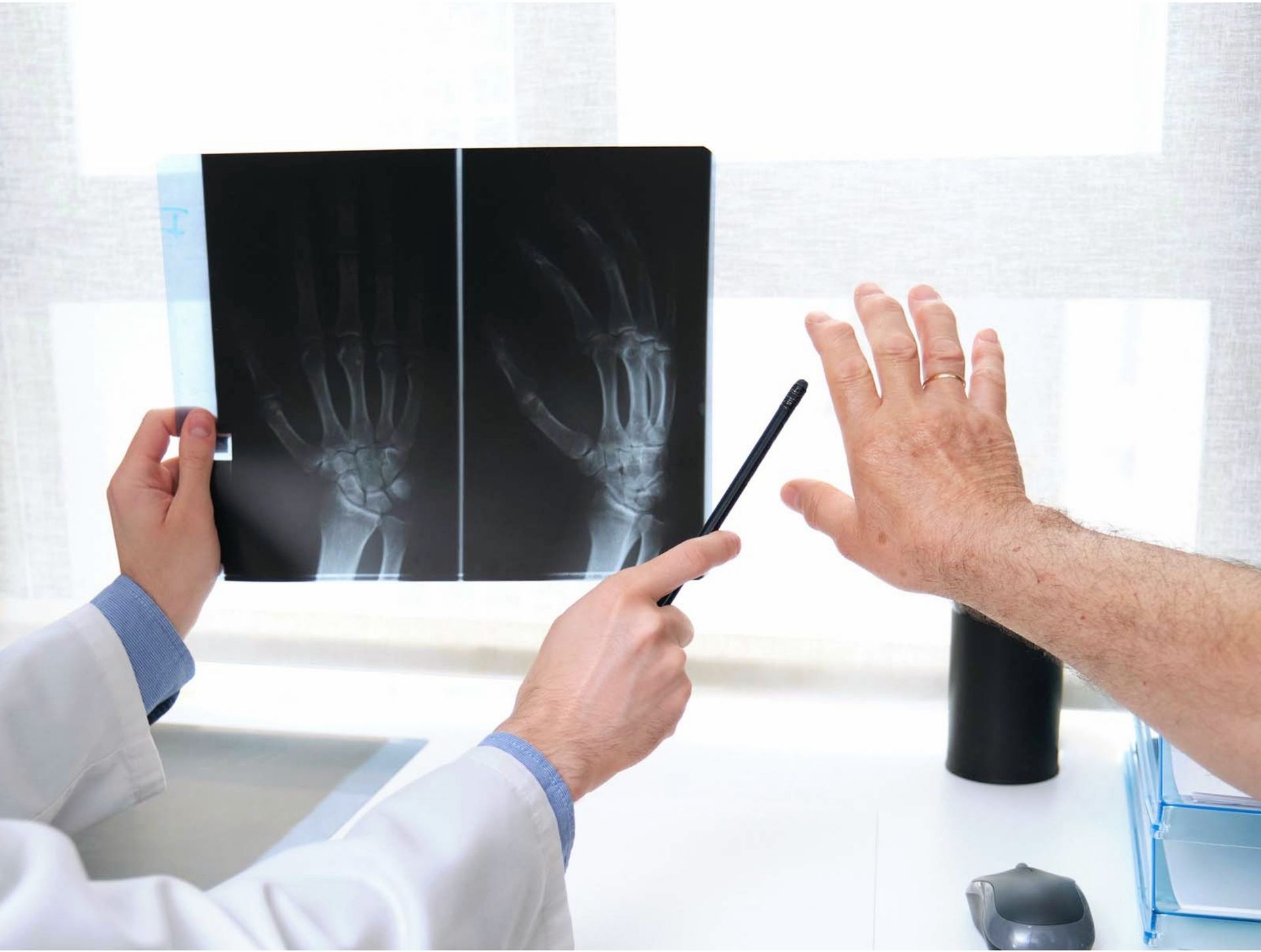 X-ray of two hands; one normal, the other with red, inflamed joints, indicating arthritis.