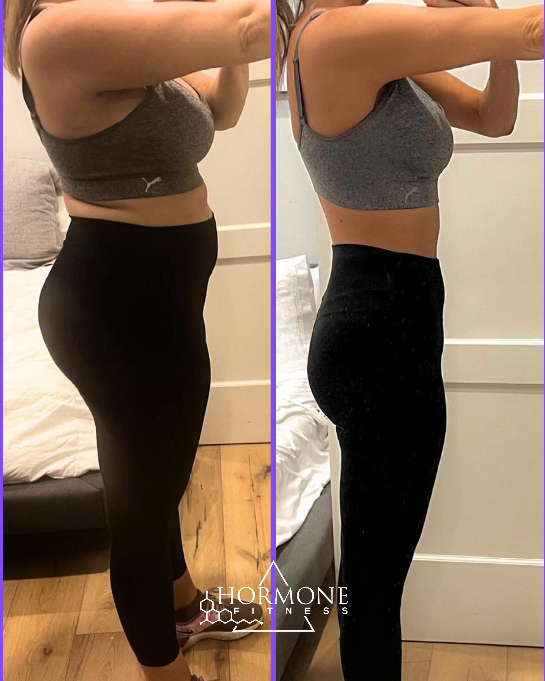 A before and after weight loss transformation taken at a side angle of a white woman's torso