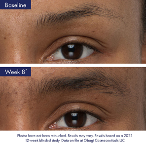 Obagi Nu-Cil Eyebrow Boosting Serum progress graphic
