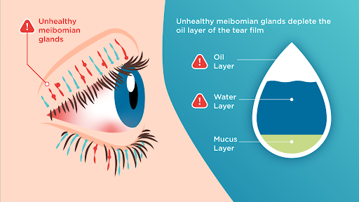 A diagram of a person 's eye and a drop of water.
