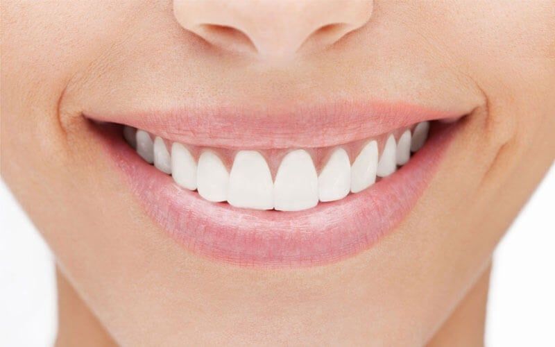 A close up of a woman 's smile with white teeth