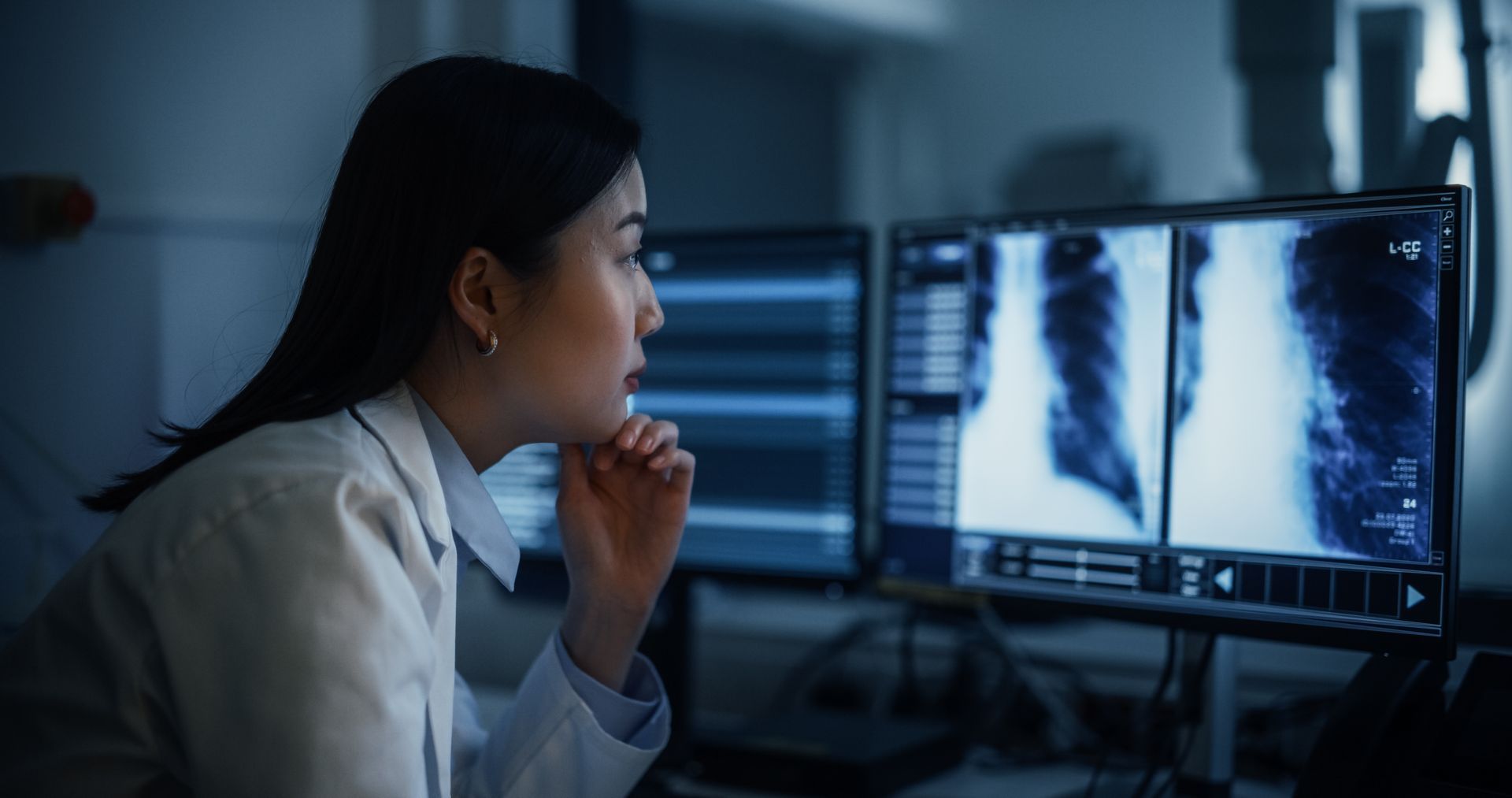 Doctor analyzing lung X-rays on computer monitors in a medical setting.
