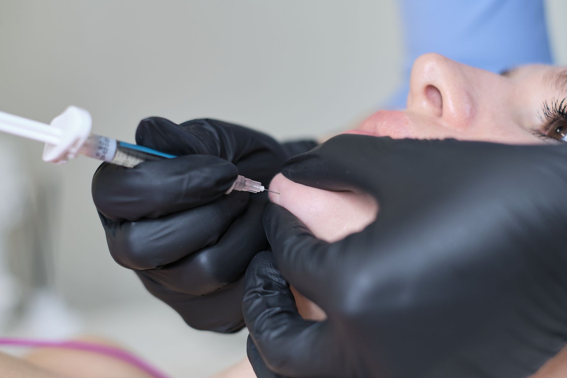 Cosmetic injectable treatment administered to the chin area using a precision syringe.